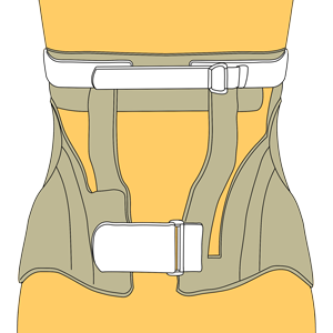 腰の硬性補装具