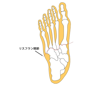 リスフラン関節