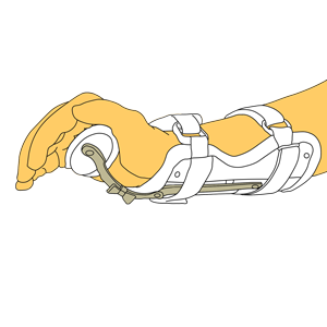 前腕の硬性補装具